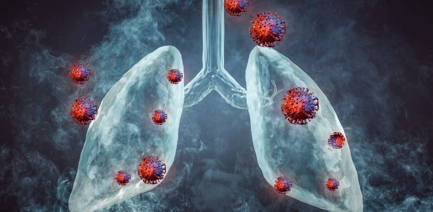 Akciğer kanseri hastaları nasıl beslenmeli?