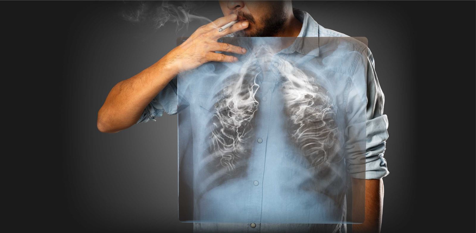 Akciğer kanserinin yüzde 90 sebebi sigaradır.