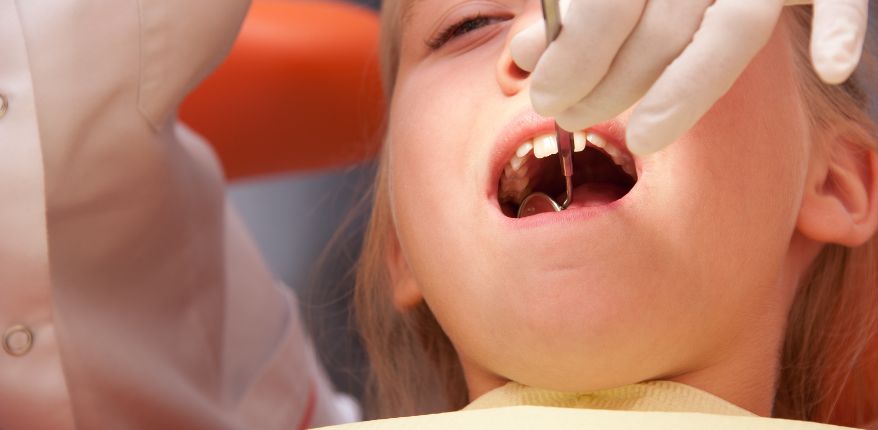 Bebekler ve çocuklar için diş çürüğünü önlemeye yönelik koruyucu tedaviler.