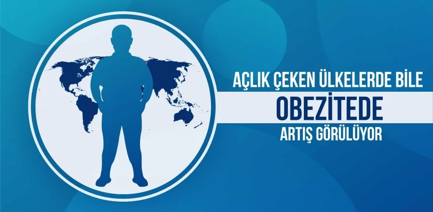 Açlık Çeken Ülkelerde Bile Obezitede Artış Görülüyor