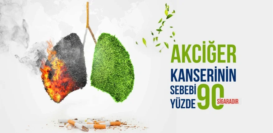 Akciğer Kanserinin Sebebi Yüzde 90 Oranında Sigaradır