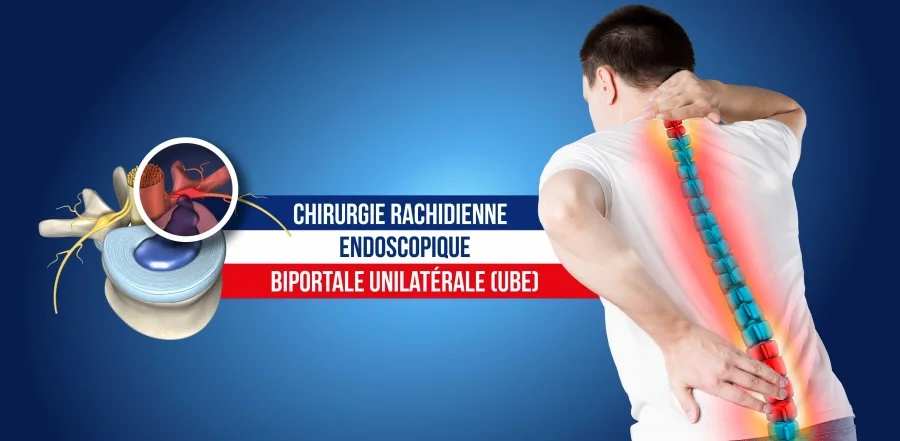 Chirurgie Rachidienne Endoscopique Biportale Unilatérale (UBE)