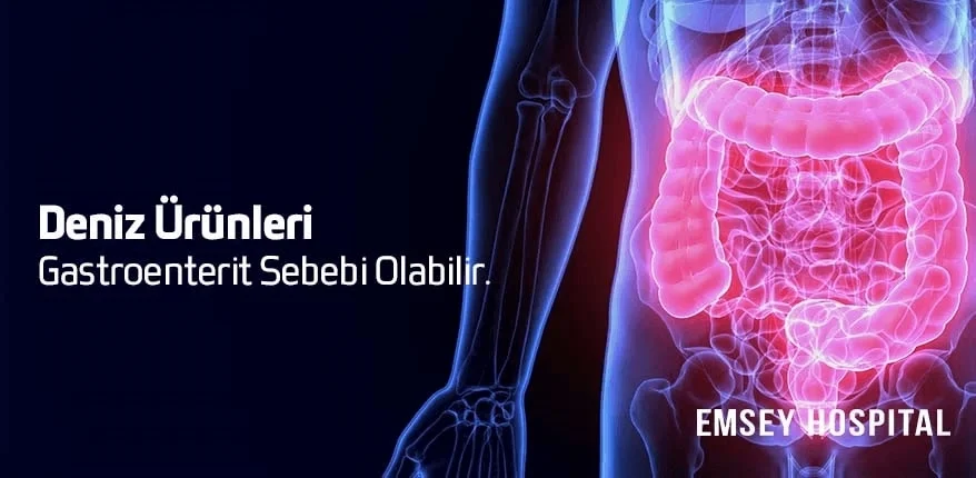 Deniz Ürünleri Gastroenterit Sebebi Olabilir.