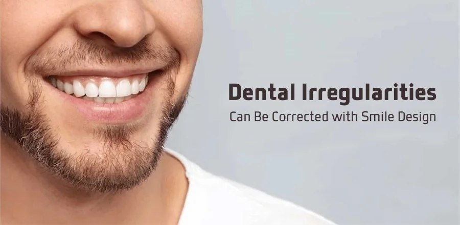 Dental Irregularities Can Be Corrected with Smile Design
