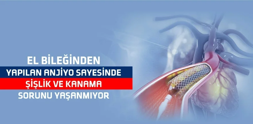 El Bileğinden Yapılan Anjiyo Sayesinde Şişlik Ve Kanama Sorunu Yaşanmıyor