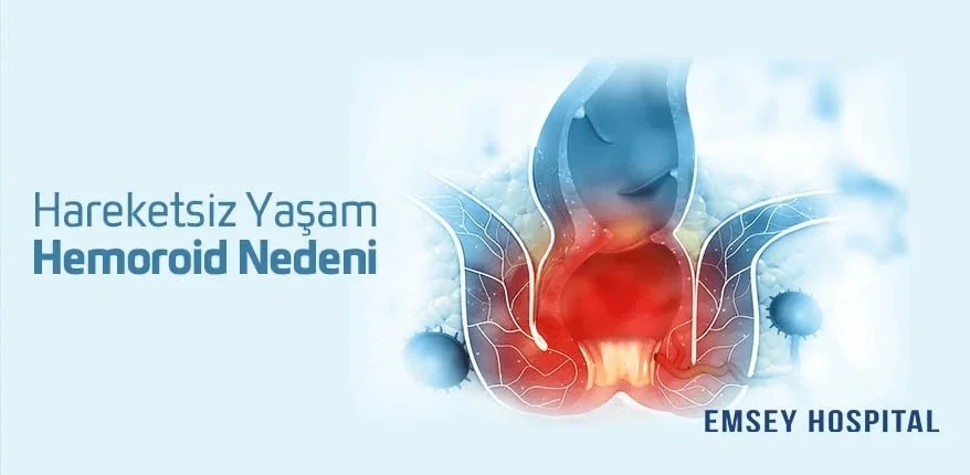 Hareketsiz Yaşam Hemoroid Nedeni