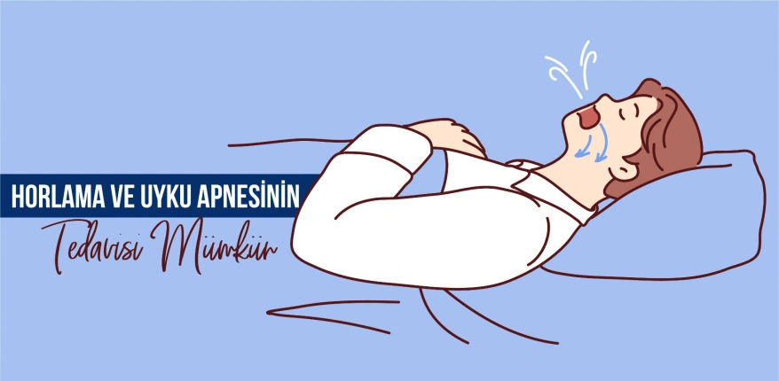 Horlama Ve Uyku Apnesinin Tedavisi Mümkün