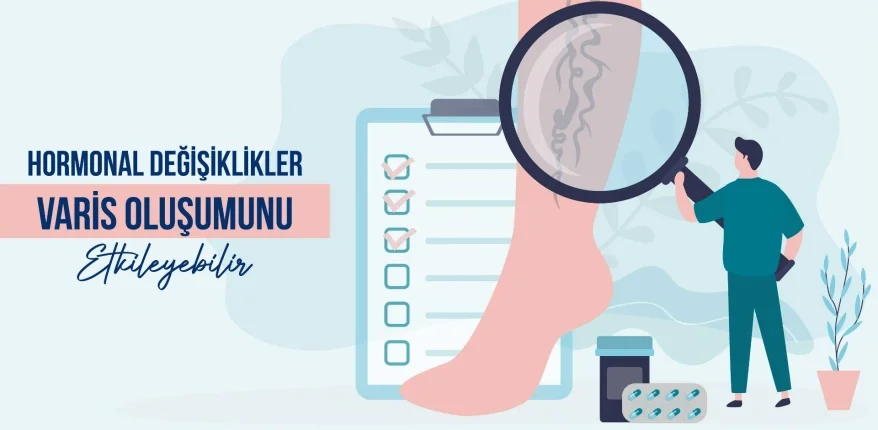 Hormonal Değişiklikler Varis Oluşumunu Etkileyebilir