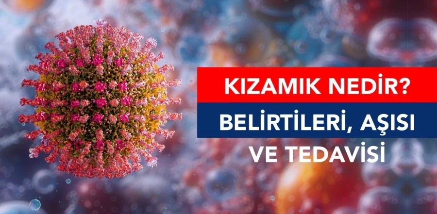 Kızamık Nedir? Belirtileri, Aşısı ve Tedavisi