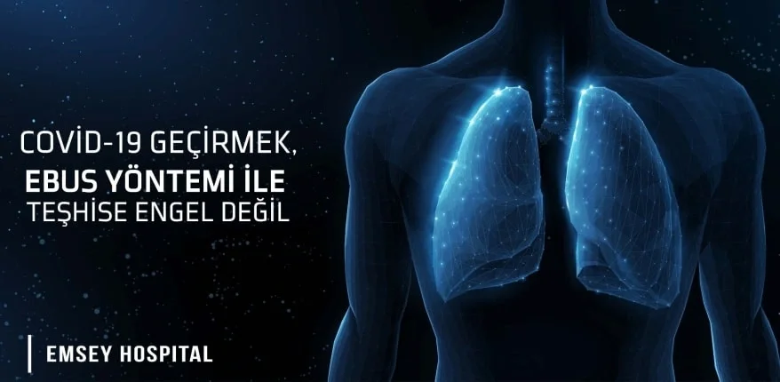 Kovid-19 geçirmek, EBUS yöntemi ile teşhise engel değil