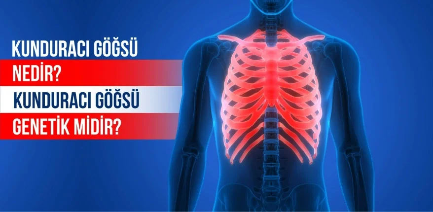 Kunduracı Göğsü Nedir? Kunduracı Göğsü Genetik midir?