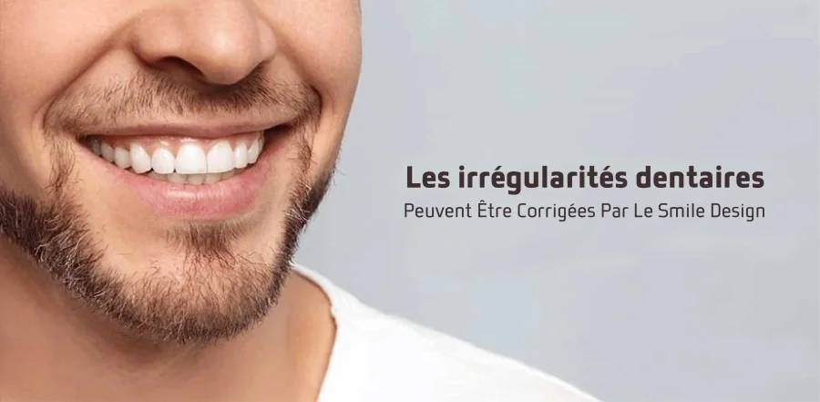 Les irrégularités dentaires peuvent être corrigées par le smile design