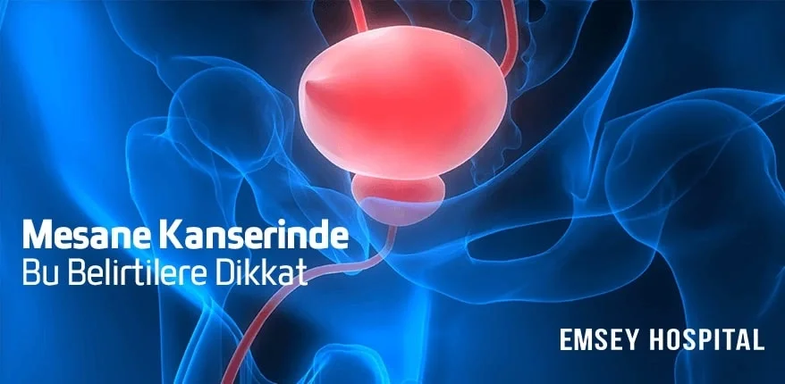 Mesane Kanserinde Bu Belirtilere Dikkat
