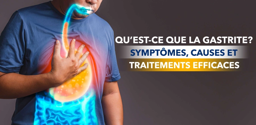 Qu’est-ce que la gastrite ? Symptômes, causes et méthodes de traitement