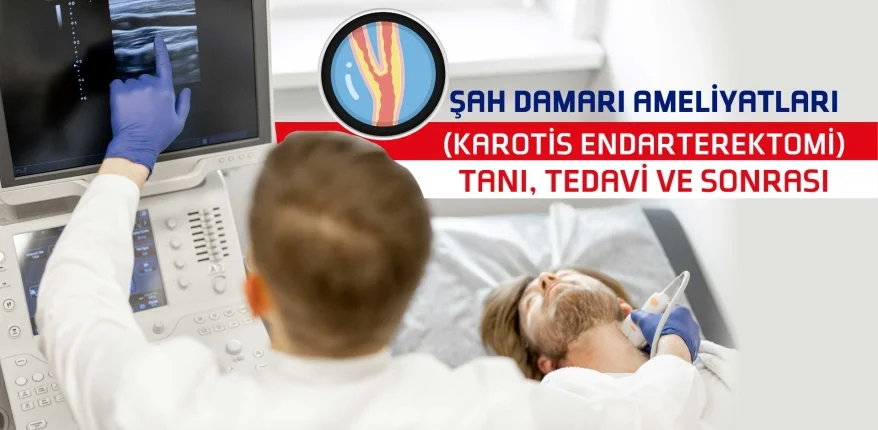Şah Damarı Ameliyatları (Karotis Endarterektomi) – Tanı, Tedavi ve Sonrası