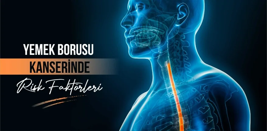 Yemek Borusu Kanserinde Risk Faktörleri
