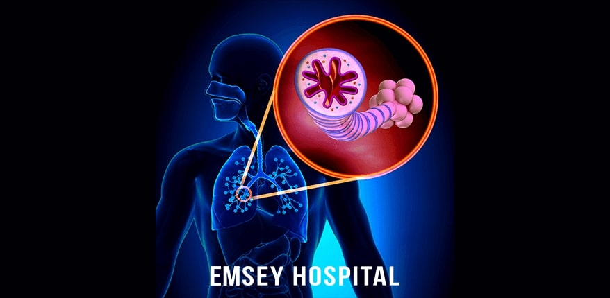 Akciğer Embolisi ve DVT (Derin Ven Trombozu) Tedavisi Nasıl Gerçekleşir?